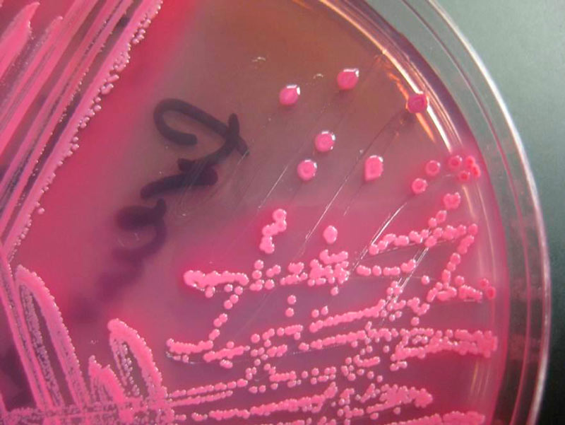 Влияние антибиотика на бактерии