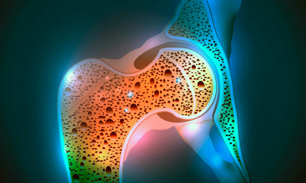 Противопоказание к приему препарата - остеопороз